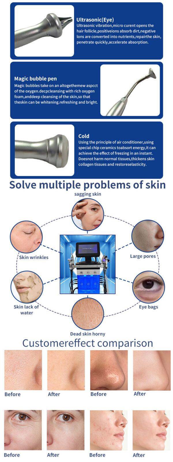 11 in 1 Ice Blue Hydro Oxygen Machine Clean Skin Dermatology Exfoliating Hydration Skin Nourishmen - Image 3